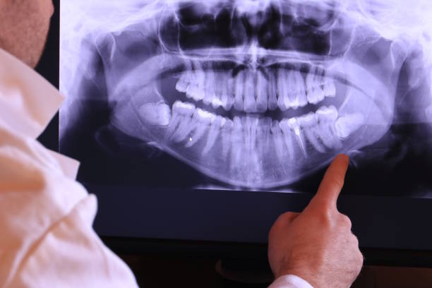 Best Emergency Dentist for Knocked-Out Tooth in Sharon Hill, PA